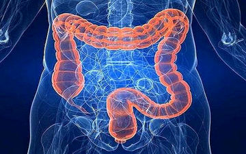 
اینفوگرافیک| تشخیص زودهنگام سرطان روده با پنج علامت