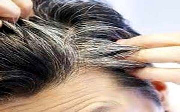  چرا موی سر در نوجوانی سفید می شود؟