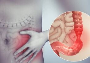  انسداد روده چیست؟ علائم خطرناکی که نباید نادیده بگیرید