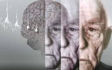 علائمی که خبر از شروع آلزایمر می دهد