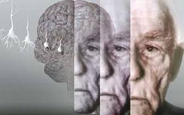 علائمی که خبر از شروع آلزایمر می دهد
