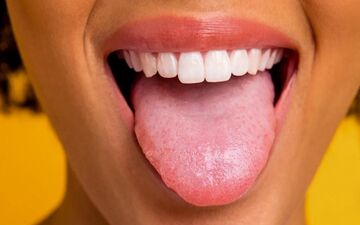 رنگ زبان شما چه پیامی درباره سلامتیتان دارد؟


