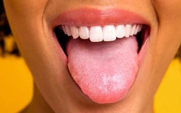 رنگ زبان شما چه پیامی درباره سلامتیتان دارد؟


