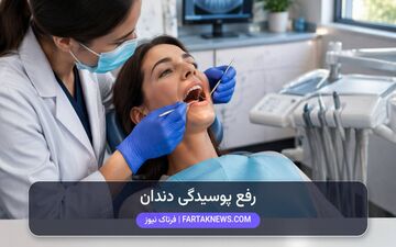 ۶ روش مؤثر برای جلوگیری از پوسیدگی دندان