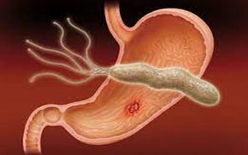 میکروب معده چه علائمی دارد؟ + اینفوگرافی
