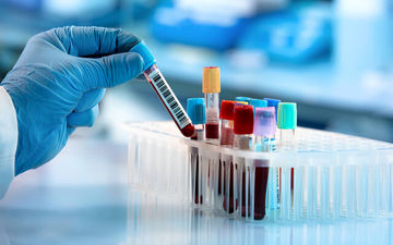 مبنای تشخیص قطعی کووید_۱۹، انجام تست‌های PCR است