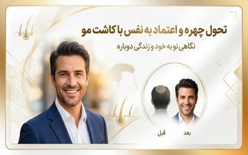 تأثیر تغییرات کوچک بر زیبایی چهره شما