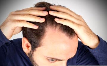  این غذاها را نخورید تا ریزش مو نگیرید

