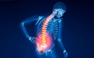 
چطور تشخیص دهیم به پوکی استخوان مبتلا هستیم؟