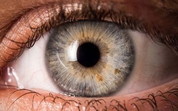 لکه‌های روی عنبیه چشم ، چه چیزی درمورد سلامتتان می گوید؟