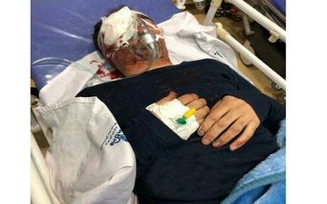 حادثه وحشتناک برای تکنسین هواپیما در اهواز / چشم او تخلیه شد + عکس