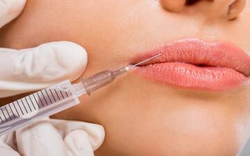 راز لب‌های طبیعی و جذاب: چقدر ژل تزریق کنیم که مصنوعی نشه؟