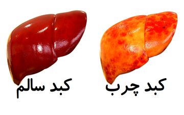 روش‌هایی برای فرار از کبد چرب