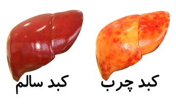 روش‌هایی برای فرار از کبد چرب