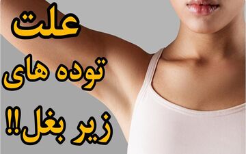همه علت های درد زیر بغل و بیماریهای مرتبط با آن