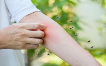 پشه‌ها بر چه اساسی بعضی‌ها را بیشتر نیش می‌زنند؟