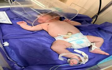 تولد نوزاد فوق سنگین در کرمانشاه!/ نوزاد ۵ کیلو و ۶۵۰ گرمی چشم به جهان گشود