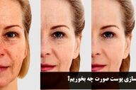 جوانسازی پوست صورت با تغذیه + روش سریع خانگی