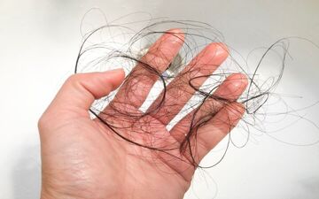 بیوتین چیست؟ این ویتامین از ریزش مو جلوگیری می‌کند