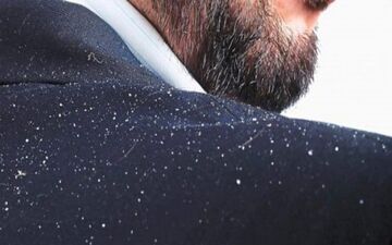 مراقبت از موها در فصل سرما/ هر آن چه که باید بدانید
