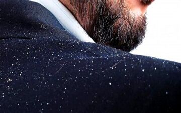 
مراقبت از موها در فصل سرما