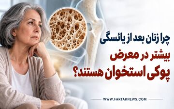 چرا زنان بعد از یائسگی بیشتر در معرض پوکی استخوان هستند؟
