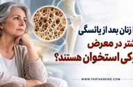 چرا زنان بعد از یائسگی بیشتر در معرض پوکی استخوان هستند؟