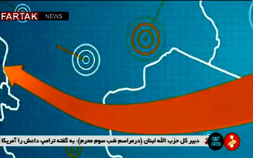 جزییات عمل جراحی پیچیده ۱۹ ساعته سرطان تیروئید + فیلم