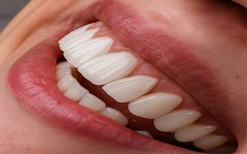 هشدار درباره تبلیغات فریبنده دندانپزشکی ارزان در فضای مجازی
