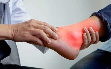 چه زمانی نقرس رخ می‌دهد؟