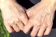چه زمانی نمایان شدن رگ‌ها طبیعی است و چه زمانی نشانه بیماری؟