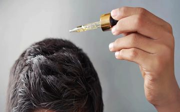 ماینوکسیدیل برای ریزش مو خوب است؟


