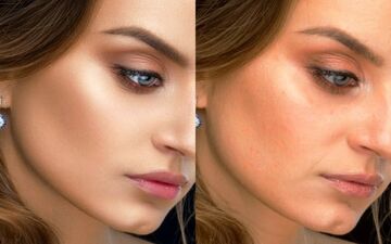 راهکارهایی برای داشتن پوستی بدون جوش