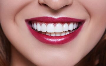 کامپوزیت دندان چیست و چطور انجام میشود؟