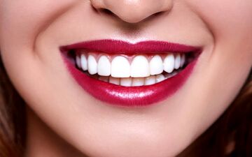 کامپوزیت دندان چیست و چطور انجام میشود؟