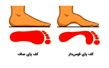 تست شخصیت قوس کف پا: نوع انحنای کف پا از ویژگی‌های شخصیتی شما خبر می‌دهد!
