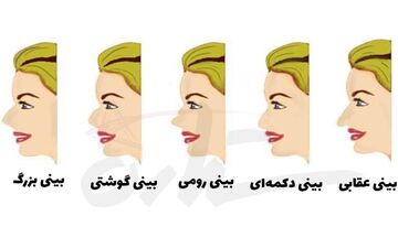 تست شخصیت شناسی | به فرم بینی اطرافیانت دقت کن و به شخصیت آنها پی ببر