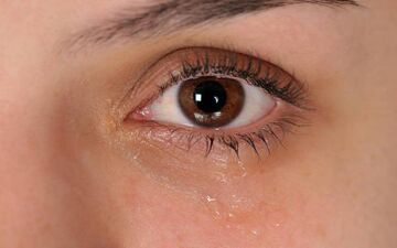 خشکی چشم چگونه درمان می‌شود؟