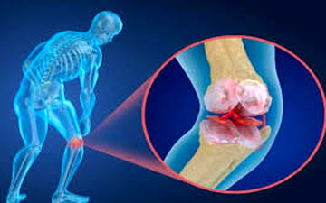 با این روش از پوکی استخوان جلوگیری کنید