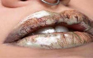  این ادویه لب های شما را قلوه ای و حجیم می کند