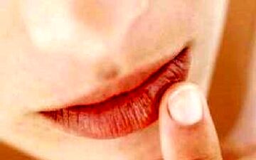 چگونه مانع خشکی و ترک خوردن لب‌ها شویم؟