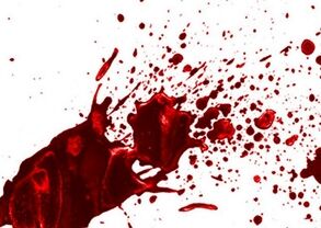 قتل در پوشش تصادف؛ راز جنایت پرند در کمتر از ۲۴ ساعت فاش شد