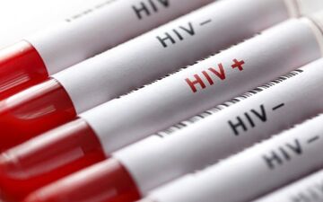 آزمایش ایدز رایگان و محرمانه انجام می‌شود/ازدواج و اشتغال 2 چالش اجتماعی مبتلایان HIV