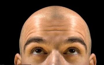 دستور ساخت یک ترکیب گیاهی ساده برای جلوگیری از "ریزش مو"