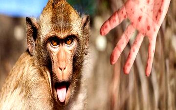 
روش جدید برای تزریق واکسن آبله میمونی