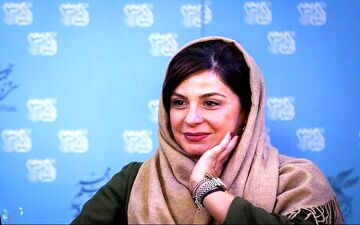 عکس/ تغییر چهره مصنوعی سیما تیرانداز برایش دردسرساز شد!