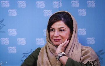 عکس/ تغییر چهره مصنوعی سیما تیرانداز برایش دردسرساز شد!