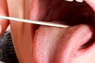 بزاق دهانتان چه چیزی را آشکار میکند؟