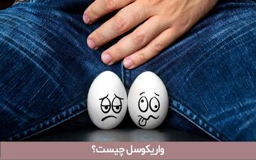 واریکوسل، مشکلی که بر باروری مردان تأثیر می‌گذارد | هرآنچه باید از واریکوسل بدانید