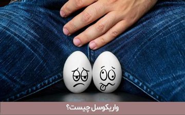 واریکوسل، مشکلی که بر باروری مردان تأثیر می‌گذارد | هرآنچه باید از واریکوسل بدانید